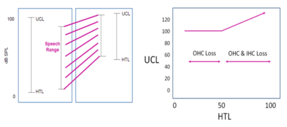 Assumptions about sensorineural hearing loss