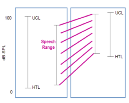 An illustration of moving the speech range into the patient's dynamic range