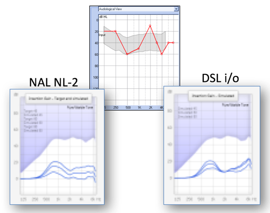 NAL NL-2 versus DSL i/o responses