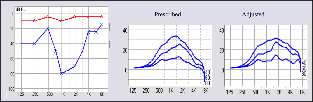 Prescribed versus adjusted frequency response for an irregularly shaped audiogram