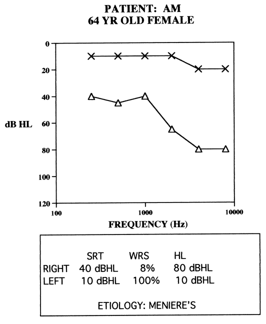 Case example Patient AM