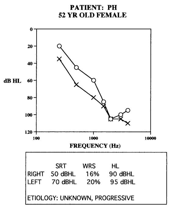 Case example Patient PH