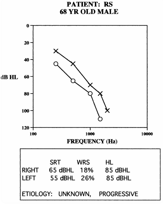 Case example Patient RS