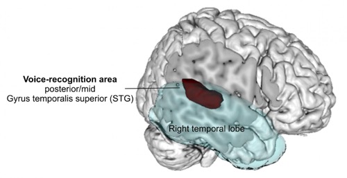 Especially persons with lesions in certain areas of the right posterior temporal lobe experienced difficulties recognizing voices
