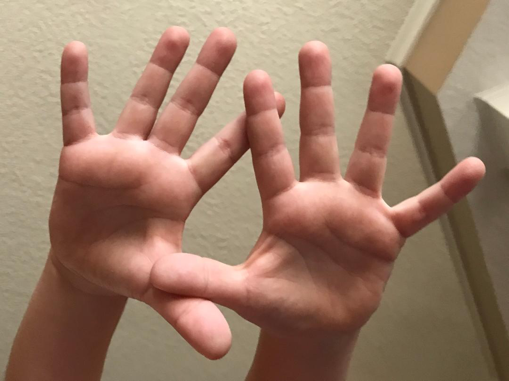 Hand arches shown using two hands from a preschool aged child