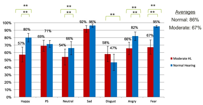 Unaided comparisons normal hearing versus moderate HL