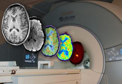 Millions of neuroimages have been acquired in more than 20,000 published activation studies with fMRI and PET imaging