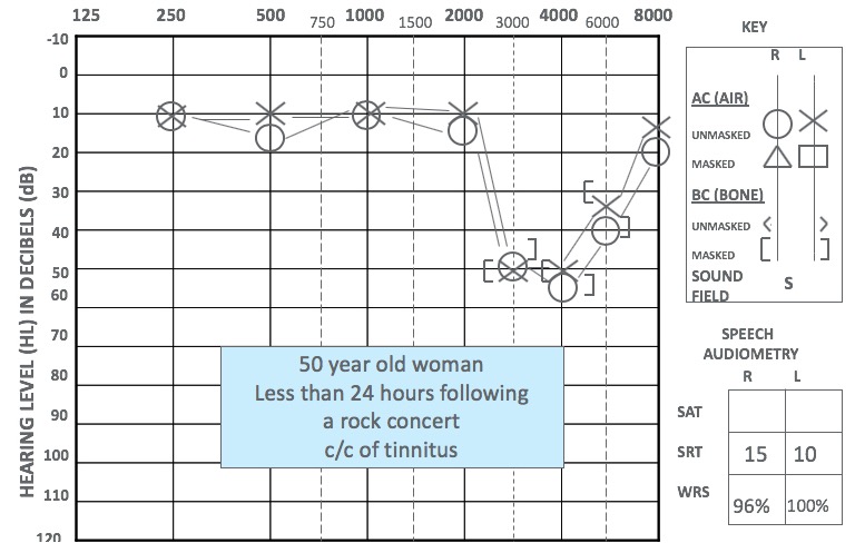 Decibel Exposure Chart