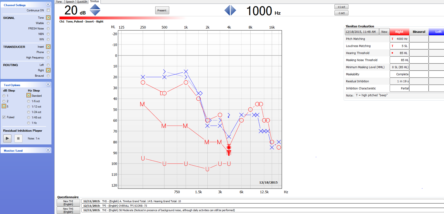 Screenshot from Astera² Tinnitus Module