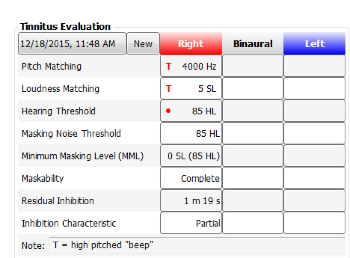 Tinnitus evaluation. billing information