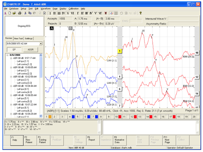 Screenshot of ABR screen during testing
