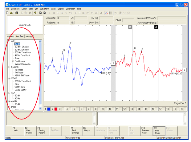 Figure panel showing (a) BERA (Brainstem evoked response audiometry) of