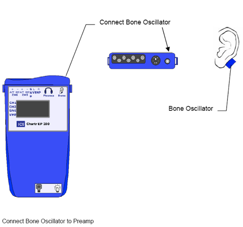 Connecting the Bone Transducer for EP 200