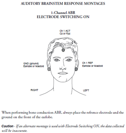 One channel recording with electrode switching on