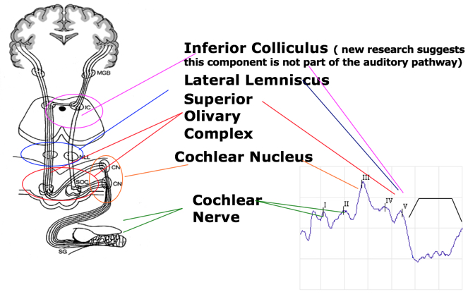 Side and back view of patient setup in a chair