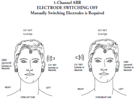 One channel recording with electrode switching on