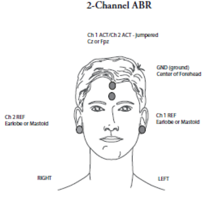 Two channel recording