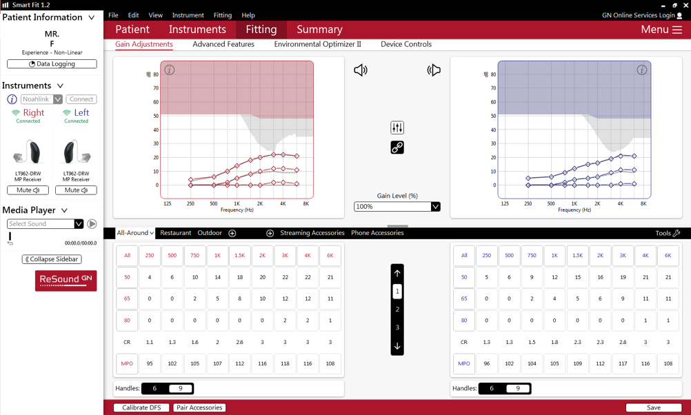 Mr. F’s default fitting in the software, using NAL-NL2 targets, in insertion gain view