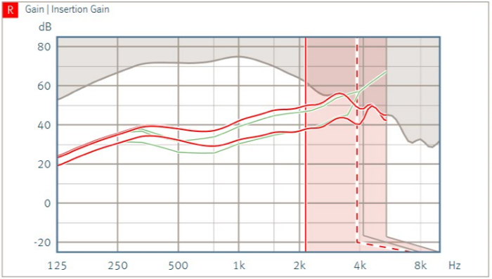 Frequency compression 2