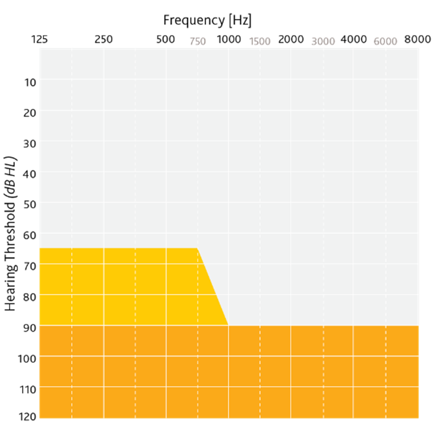 Candidacy criteria. hearing thresholds