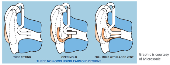 Non-occluding open earmold styles