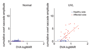 Overt saccade amplitude and DVA