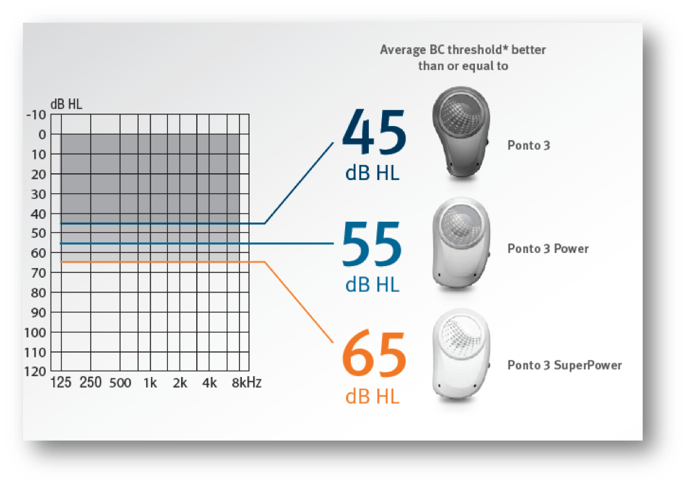 Ponto fitting ranges