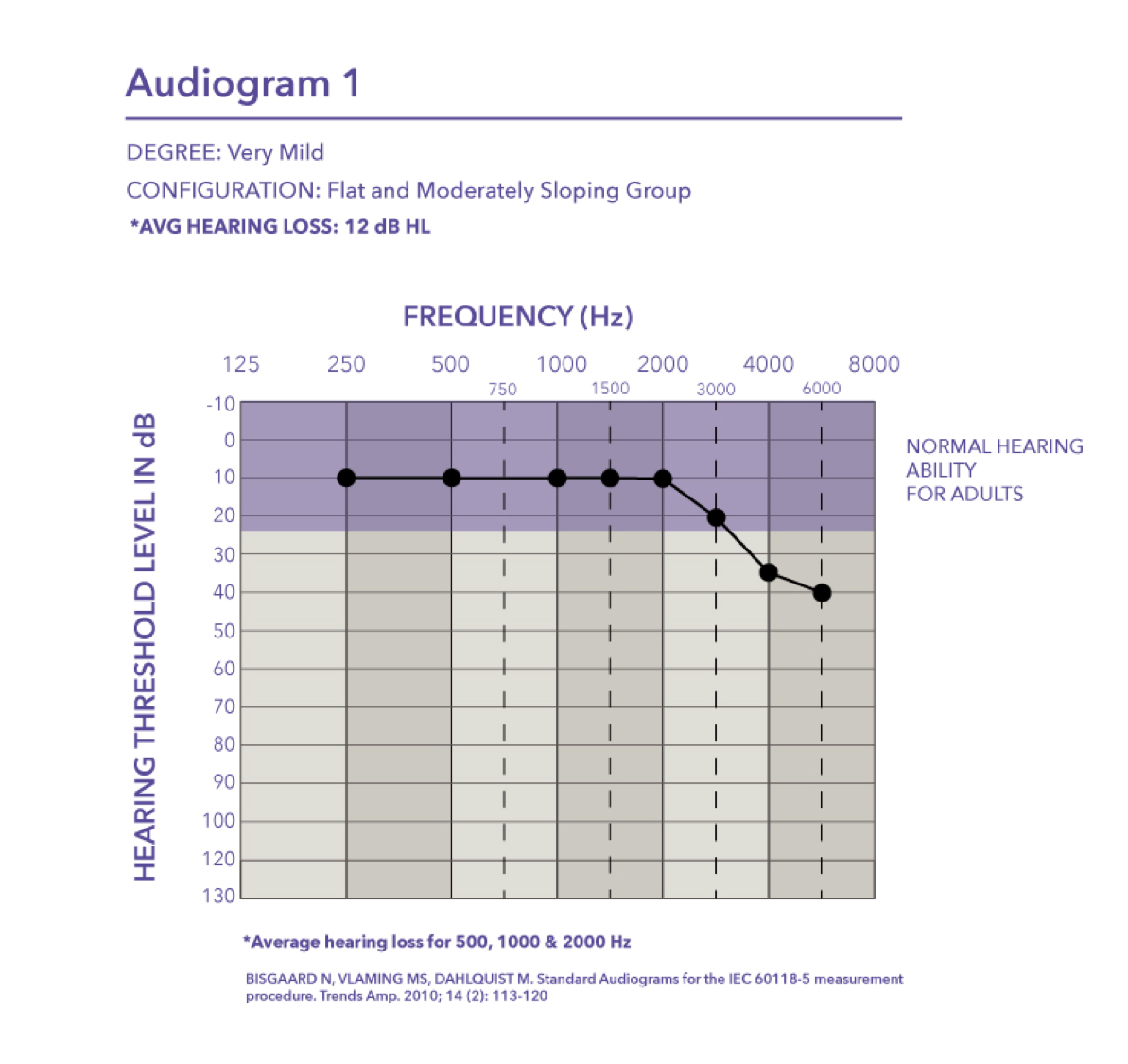 Flat and moderately sloping group of audiometric configurations with a PTA of 12 dB HL