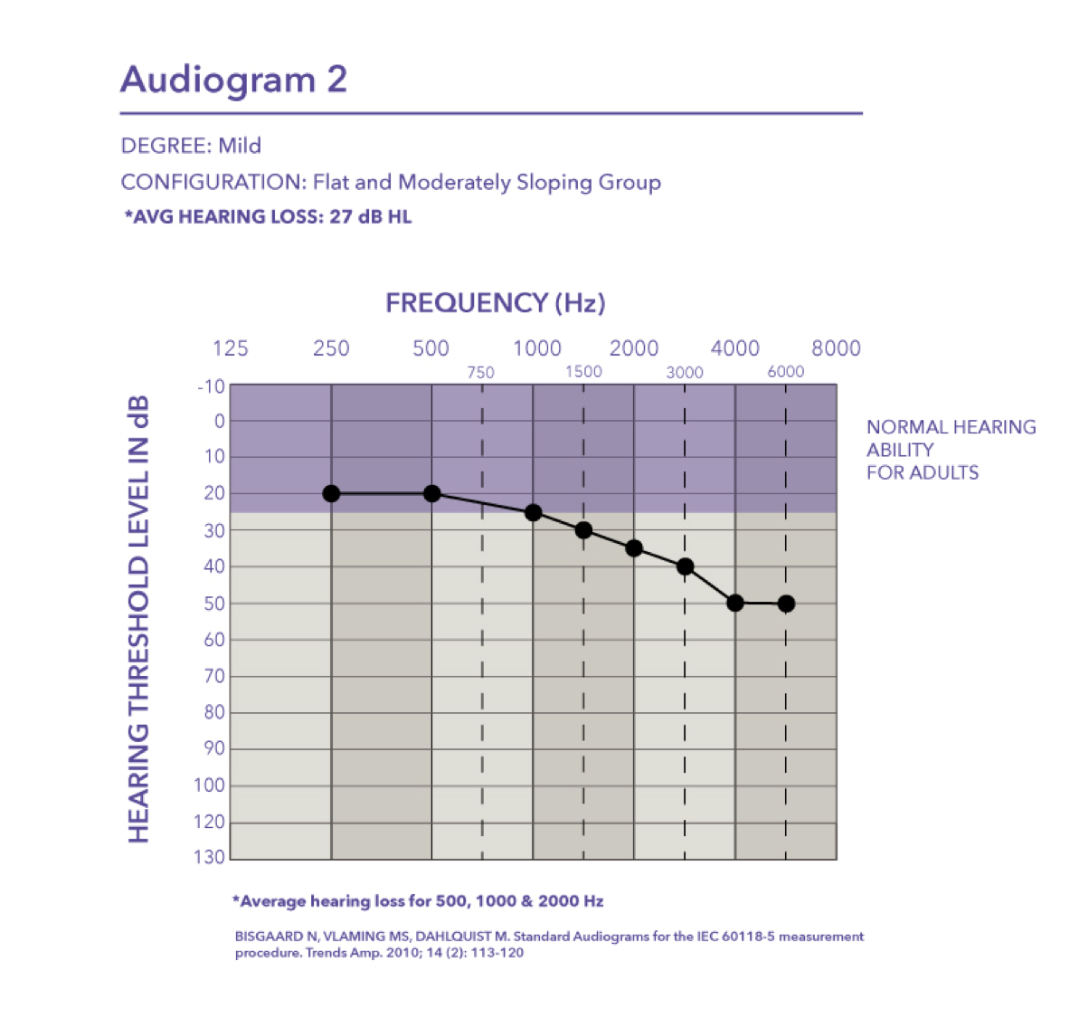 Mild hearing loss where the pure tone average is 27 dB HL