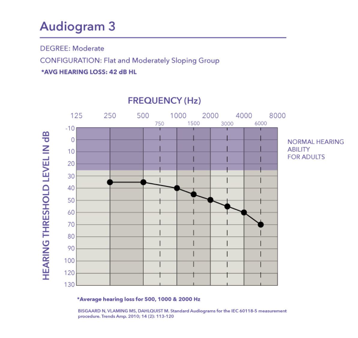 Approaching a moderate loss with the pure tone average of 42 dB HL