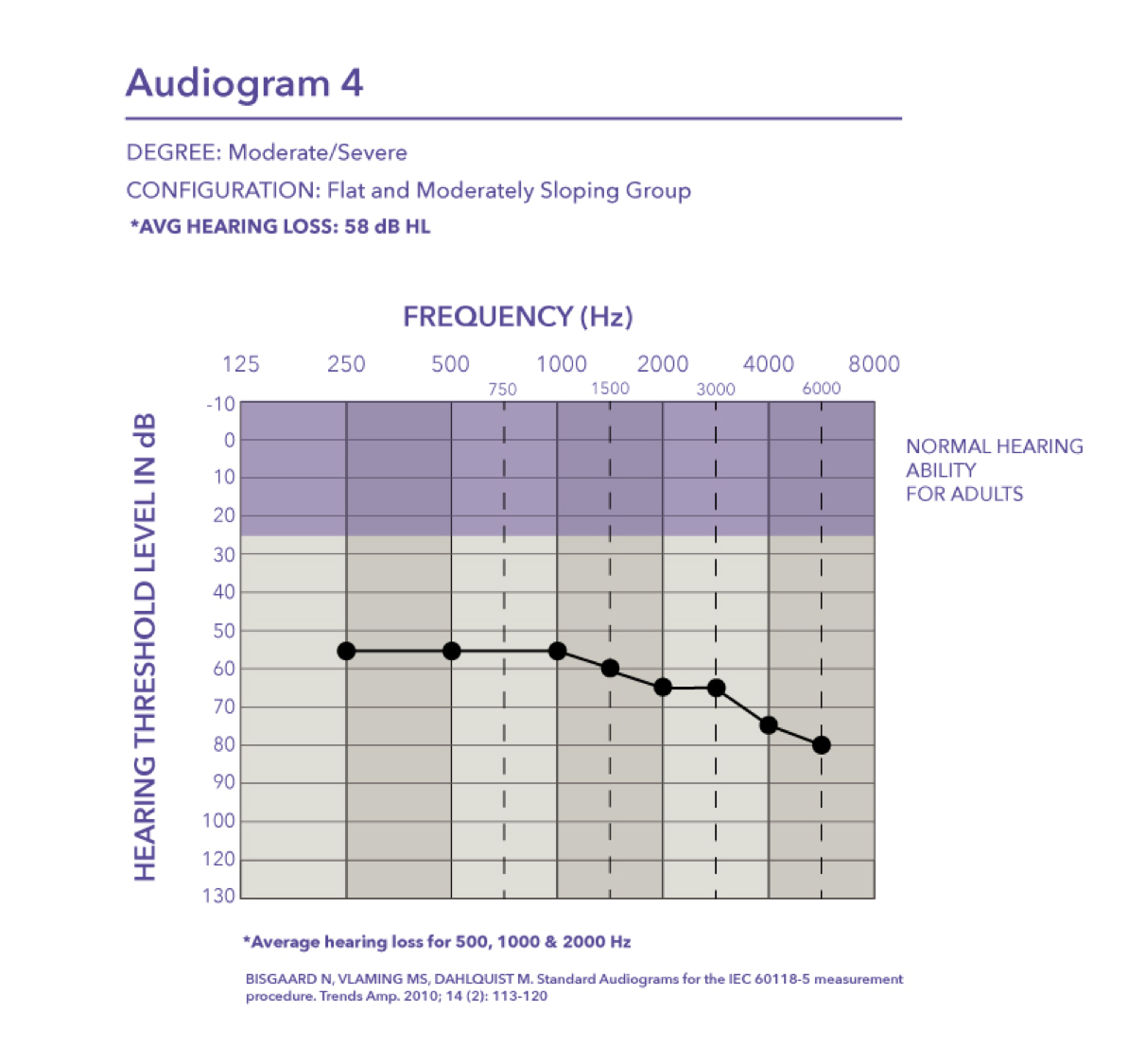 Moderate to severe hearing loss with a pure tone average of 58 dB HL