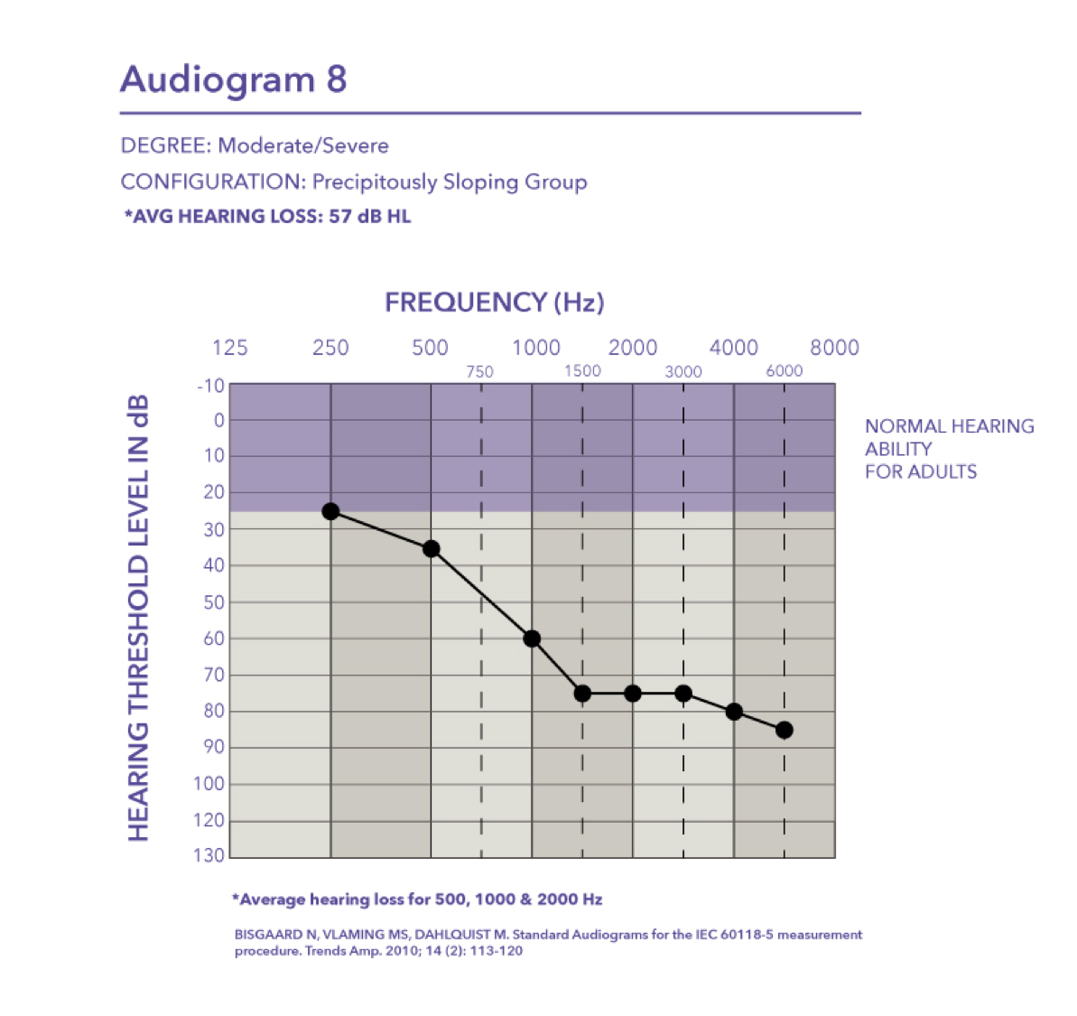 Moderate to severe degree with a pure tone average of 57 dB HL