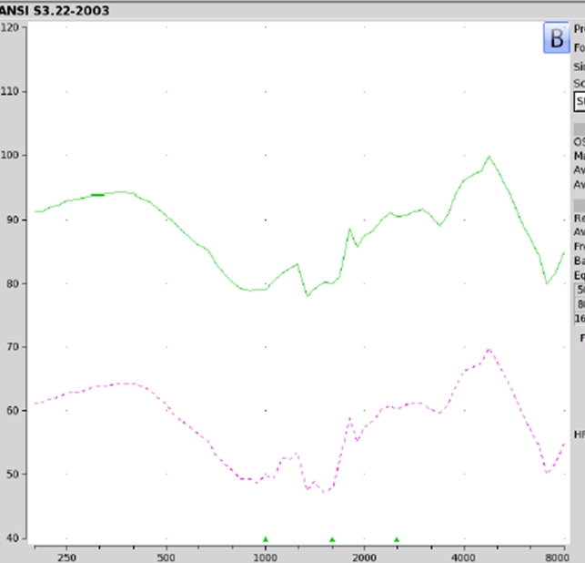 LifeEar Empower BOOST electroacoustic analysis