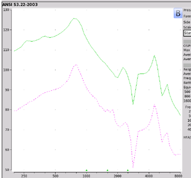 MSA 30X electroacoustic analysis