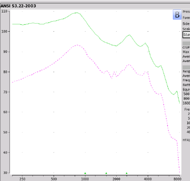 Otofonix Elite electroacoustic analysis