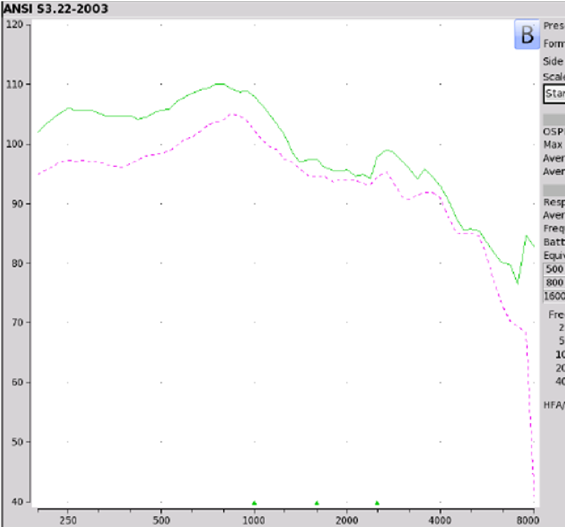 Tweak, PLAID and CliKEZ electroacoustic analysis