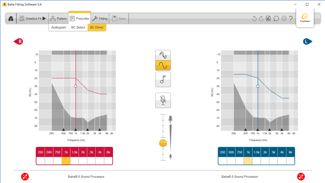 Fitting software. BC Direct and BC Select