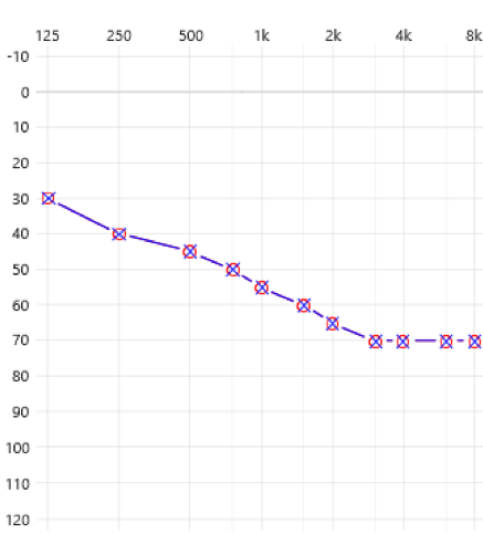 Scenario 2 Audiogram of a person requiring amplification in the lower frequencies