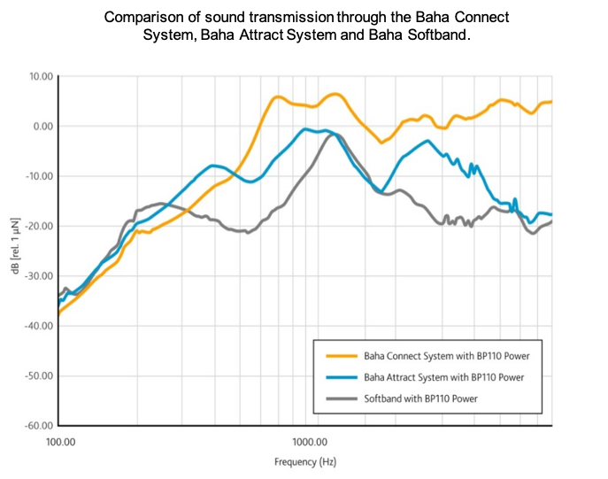 Comparison of sound transmission through the different Baha systems