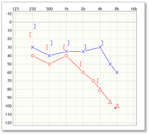 Kira's audiogram