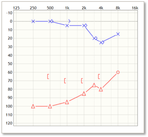 Max's audiogram