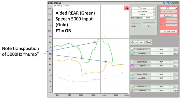 Transposition of Speech-5000 Hz hump