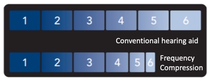 Illustration of frequency compression