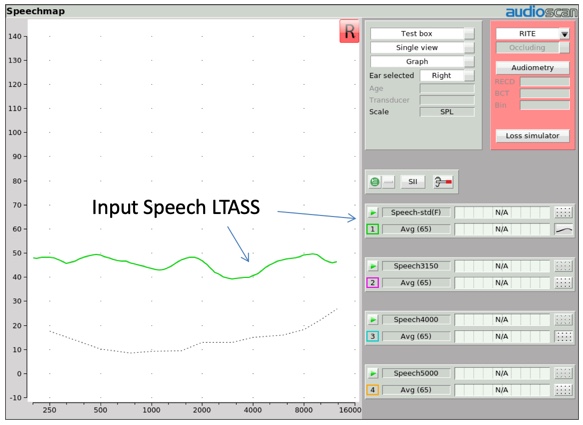 Long-term average speech spectrum for average speech
