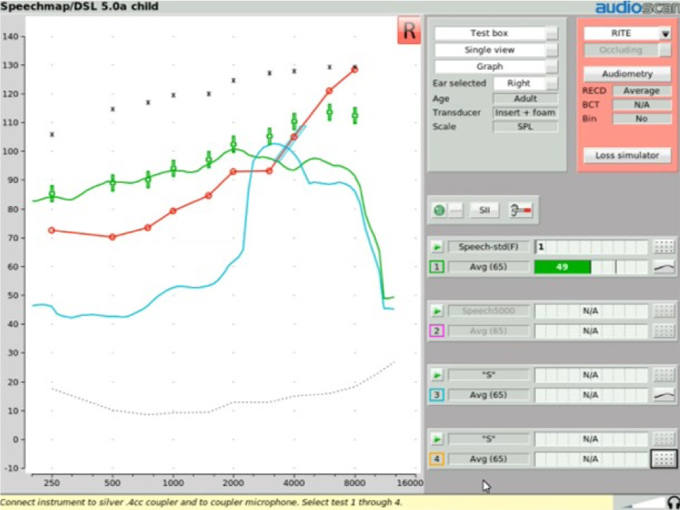 Fitting the frequency lowering feature for your patient