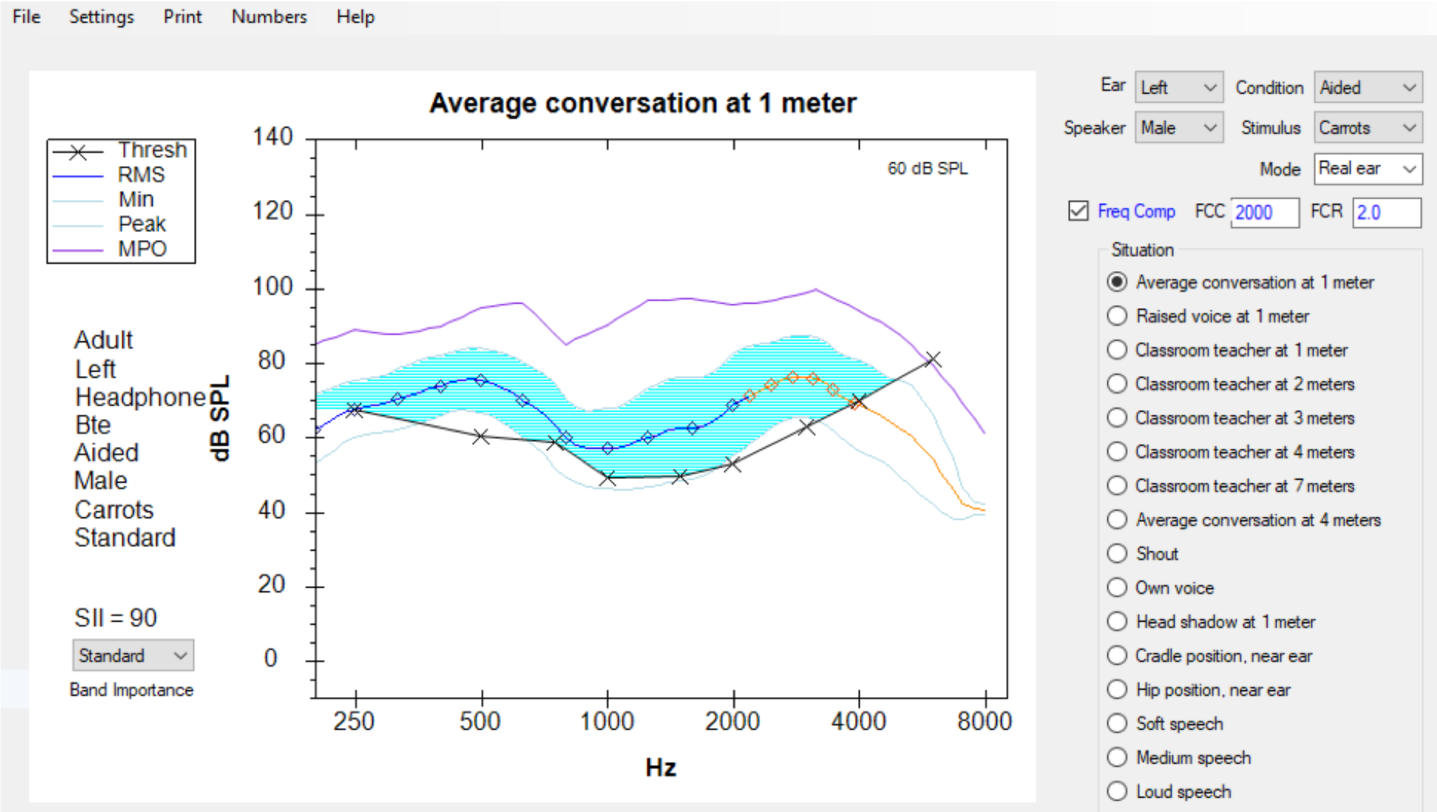 SHARP display with Frequency Compression selected