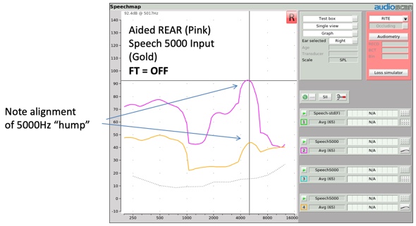 Alignment of Speech-5000 Hz hump