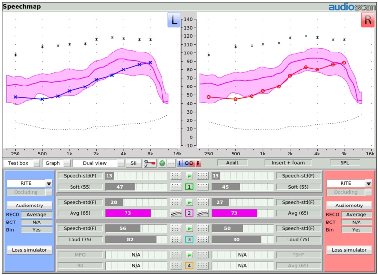 Speechmap display screen of unaided and aided SII scores