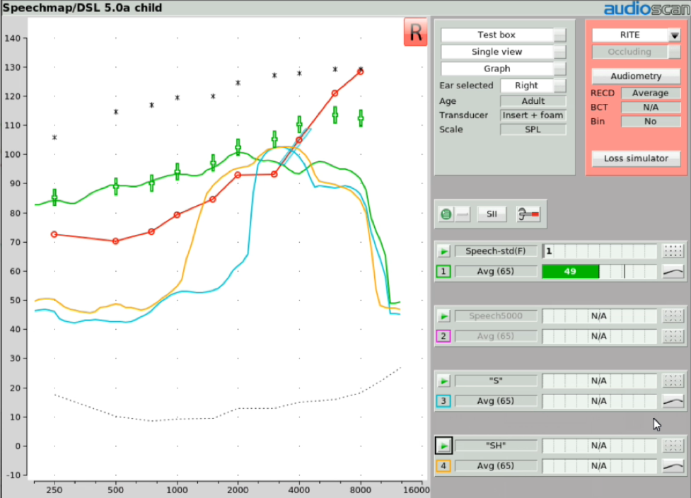 Determining the audibility of the "SH" stimulus