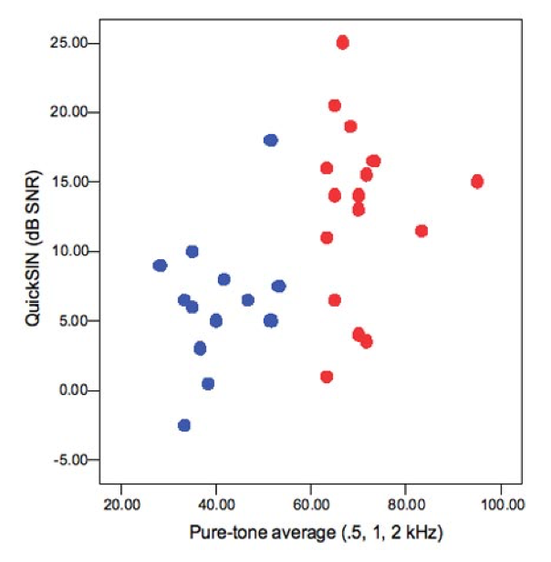 Speech understanding in noise: mild to moderate vs. severe hearing loss graph with data points shown as a function of QuickSIN and pure tone average